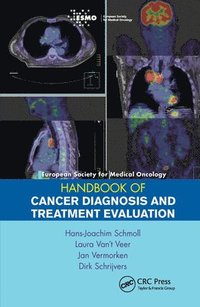 bokomslag ESMO Handbook of Cancer Diagnosis and Treatment Evaluation