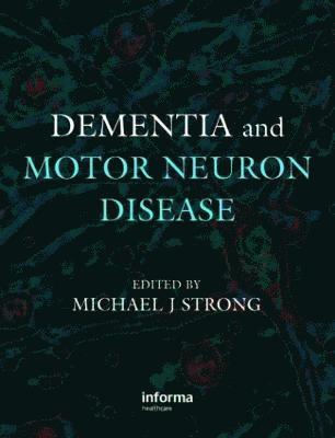 bokomslag Dementia and Motor Neuron Disease