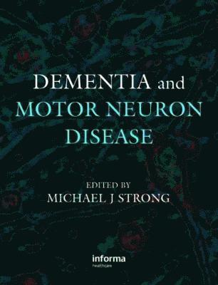 Dementia and Motor Neuron Disease 1