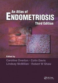 bokomslag Atlas of Endometriosis