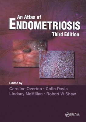 bokomslag Atlas of Endometriosis