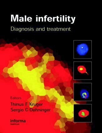 Sergio Oehninger, Thinus Kruger - Male Infertility, Inbunden