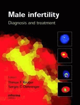 bokomslag Male Infertility