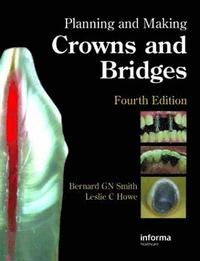 bokomslag Planning and Making Crowns and Bridges