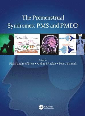 The Premenstrual Syndromes 1