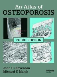 bokomslag An Atlas of Osteoporosis