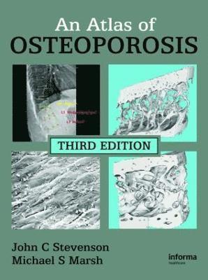 John C. Stevenson, Michael S. Marsh - Atlas of Osteoporosis, Inbunden