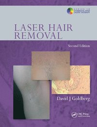 bokomslag Laser Hair Removal