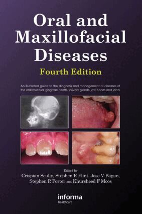 Crispian Scully, Stephen Flint - Oral and Maxillofacial Diseases, Fourth Edition, Inbunden