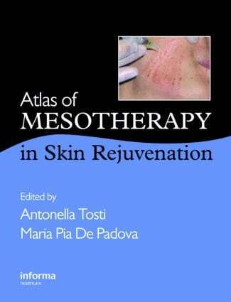 Antonella Tosti, Maria Pia De Padova - Atlas of Mesotherapy in Skin Rejuvenation, Inbunden