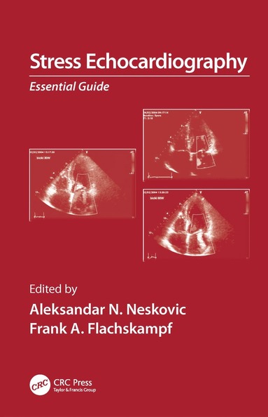 bokomslag Stress Echocardiography