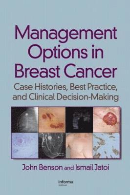 bokomslag Management Options in Breast Cancer