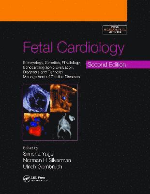 bokomslag Fetal Cardiology