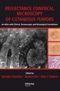 bokomslag Reflectance Confocal Microscopy of Cutaneous Tumors