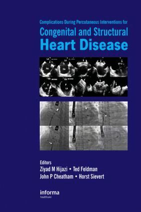 Ziyad M. Hijazi, Ted Feldman, John Cheatham, Horst Sievert - Complications During Percutaneous Interventions for Congenital and Structural Heart Disease, Inbunden