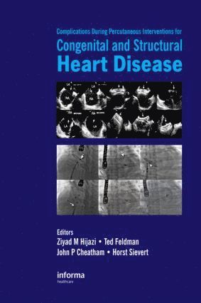 bokomslag Complications During Percutaneous Interventions for Congenital and Structural Heart Disease