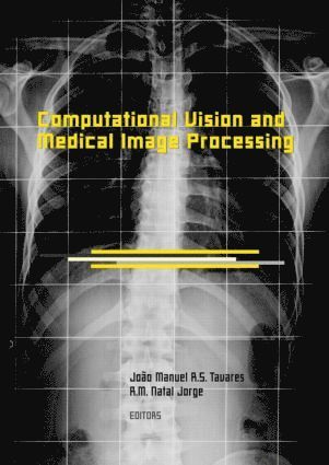 Computational Vision and Medical Image Processing 1