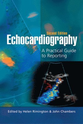 bokomslag Echocardiography