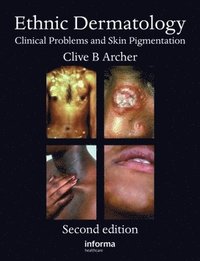 bokomslag Ethnic Dermatology