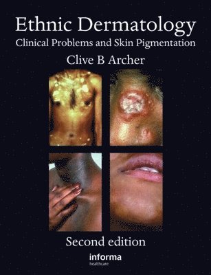 Ethnic Dermatology 1