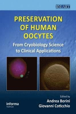 bokomslag Preservation of Human Oocytes