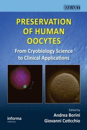 bokomslag Preservation of Human Oocytes