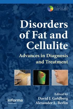 bokomslag Disorders of Fat and Cellulite