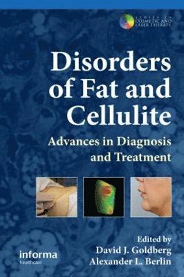 David J. Goldberg, Alexander L. Berlin, USA) Goldberg, David J. (Skin and Laser Specialists of New York and New Jersey, and Mount Sinai School of Medicine, USA) Berlin, Alexander L. (U.S. Dermatology Medical Group, Arlington, TX; Department of Dermatology, New Jersey Medical School, Newark, NJ - Disorders of Fat and Cellulite, Inbunden