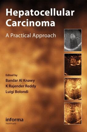 Bandar Al Knawy, K. Rajender Reddy, Luigi Bolondi - Hepatocellular Carcinoma, Inbunden