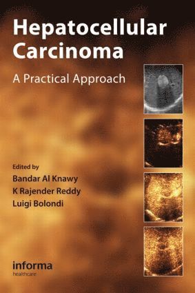 bokomslag Hepatocellular Carcinoma