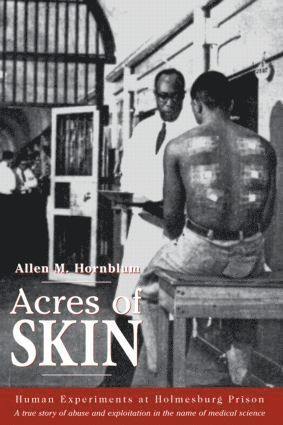 Acres of Skin
