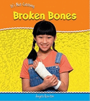 bokomslag Broken Bones