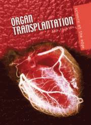 Organ Transplantation 1