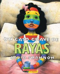 bokomslag Un Caso Grave de Rayas (a Bad Case of Stripes)