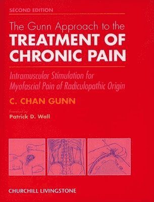 bokomslag The Gunn Approach to the Treatment of Chronic Pain