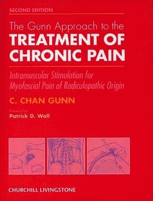 The Gunn Approach to the Treatment of Chronic Pain 1