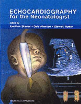 Jonathan Skinner, Dale Alverson, Susan M Hunter - Echocardiography for the Neonatologist, Inbunden
