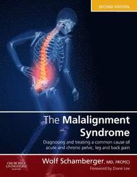 bokomslag The Malalignment Syndrome