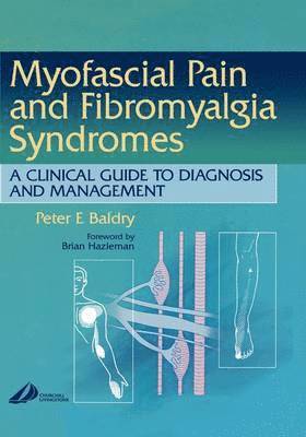 Peter E. Baldry, UK; Member of the British and Irish Chapter of the International Association for the Study of Pain; Member of the International Myopain Society) Baldry, Peter E. (Emeritus Consultant Physician and Postgraduate Clinical Tutor, Ashford Hospital, London - Myofascial Pain and Fibromyalgia Syndromes, Inbunden