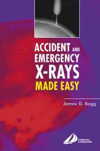 bokomslag Accident and Emergency X-Rays Made Easy