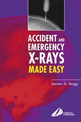 James D. Begg - Accident and Emergency X-Rays Made Easy, Häftad