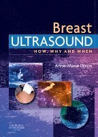 Anne-Marie Dixon - Breast Ultrasound, Inbunden
