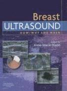 bokomslag Breast Ultrasound