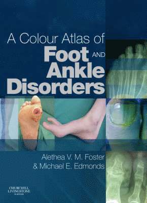 bokomslag A Colour Atlas of Foot and Ankle Disorders