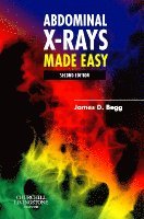 James D. Begg - Abdominal X-Rays Made Easy, Häftad