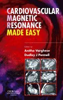 Anitha Varghese, Dudley J. Pennell - Cardiovascular Magnetic Resonance Made Easy, Häftad