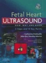 Fetal Heart Ultrasound