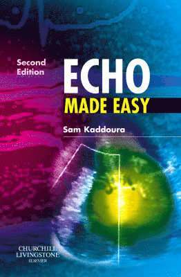 Echo Made Easy 1