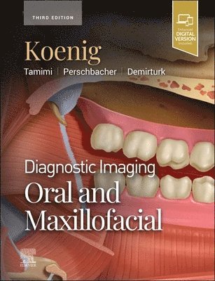 Lisa J. Koenig, Dania Tamimi, Susanne E. Perschbacher, Husniye Demirturk - Diagnostic Imaging: Oral and Maxillofacial, Inbunden