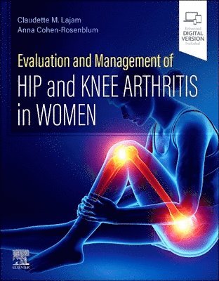 bokomslag Evaluation and Management of Hip and Knee Arthritis in Women